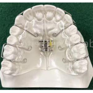 State-Of-The-Art Orthodontics Appliance Expanding Retainer Customizable