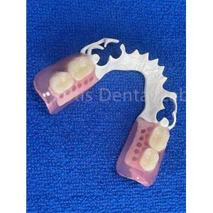 Adjustable Flexible Dental Prosthesis Stable Comfortable Immediate Partial Denture