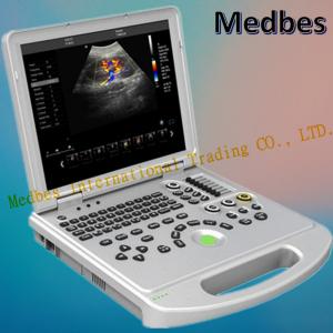 Cardiac 4D Color Doppler Echo Ultrasound Machine with Pw Cw