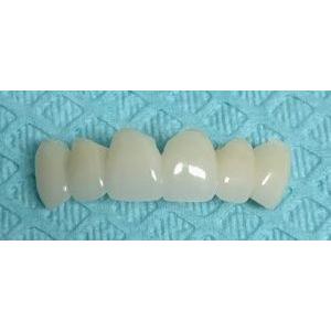 Emergency Temporary Dental Crown Implant Replacement Professional PMMA