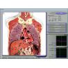 China Analisador da saúde da ressonância 3d Nls do quantum para o diagnóstico completo do corpo wholesale