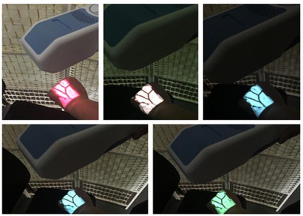 Medical Handheld Infrared Vein Finder Biometric Reader With Five Different Colors