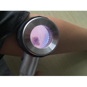 Customized Health Care Handheld Medical Dermatoscope for Skin Inspection