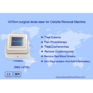 1470nm 980nm Diode Laser Lipolysis Surgery Laser Device Fat Soluble