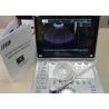 Ultrasound Scan Machine Portable Ultrasound Scanner with Scanning Depth 320mm
