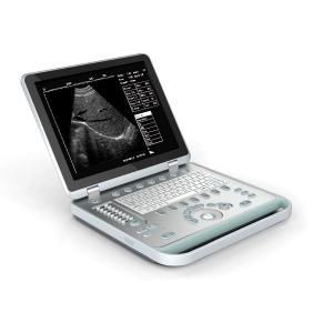 China Protable ultrasound scanner,ultrasound machine,Laptop doppler built in battery SG-S7 supplier