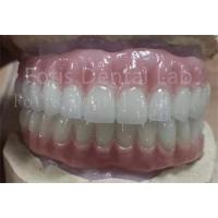 China Precise Fit Ivoclar Teeth Acrylic Complete Denture Stain Resistant on sale