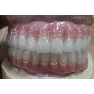 Precise Fit Ivoclar Teeth Acrylic Complete Denture Stain Resistant