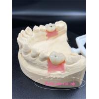 China Customization Titanium/Ziconia/PFM Dental Lab Crowns Comfortable on sale