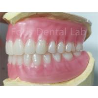 China OEM Full Upper And Lower Acrylic Denture Stain Resistance  Natural Color on sale