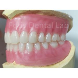 OEM Full Upper And Lower Acrylic Denture Stain Resistance  Natural Color