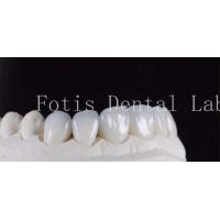 China Ultra Strong Translucent Dental Laminate Veneers Natural Color on sale