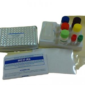 Interleukin 1 Beta elisa detection kit Human Il1b Elisa Kit Reaserch Use