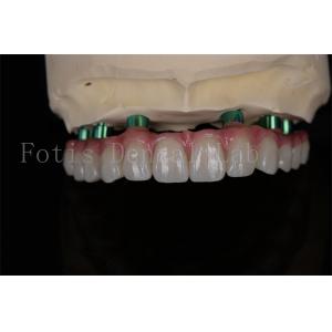 Zirconia All-on-4 Implant Procedure Same Day Recovery Minimal Follow Up Needed