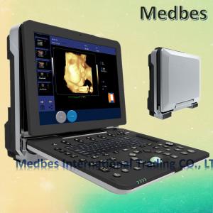 4D Realtime Musculoskeletal Ultrasound Systems fetal doppler ultrasound Ultrasound Diagnosis System