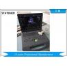 Laptop Ultrasound Color Doppler Ultrasound Scanner With 15 Inch Led Screen