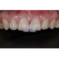 China High Translucency Dental Lab Laminate Veneers for Natural and Polishing on sale
