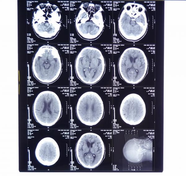 High Sharpness X-ray Dry Dental medical Film, Dry imaging film. x ray laser film