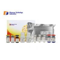 China Customized Human ECP Sandwich ELISA Kit High Specificity Eosinophil Cationic Protein on sale
