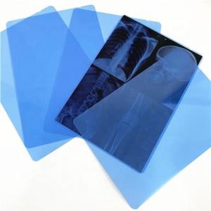 China 210 Micron 14X54m Blue X Ray Film Roll For Inkjet Printing supplier