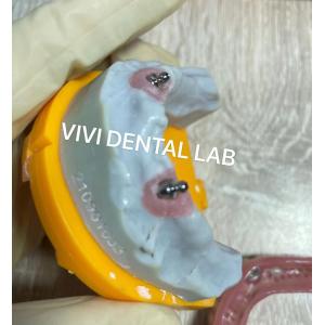 Ivoclar Implant Ball Attachments Removable Dental Implant Material For Oral Hygiene