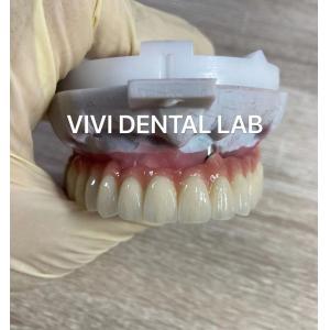 China Scheftner Ivoclar Porcelain Fused Metal Crowns Dental SLM Technique supplier
