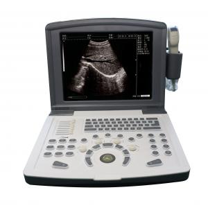 Portable Full Digital Diagnostic Ultrasound scanner OEM