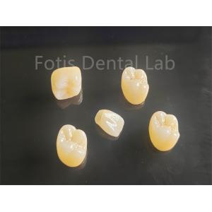 Aesthetic Appeal Full Porcelain Layered Zirconia Ideal For Crowns Bridges