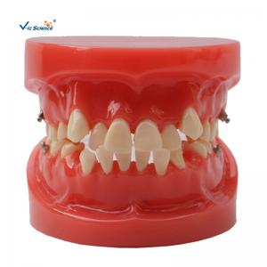 China Orthodontic Dental Study Models Tooth Teaching , Dental Models For Patient Education supplier