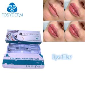 China Filling Face Injection Fosyderm Fosyderm Hyaluronic Acid Lip Fillers 1ml supplier