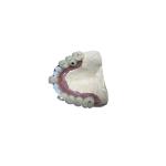 Accurate Biocompatibility Dental Implant Attachments Tooth Implant Crown