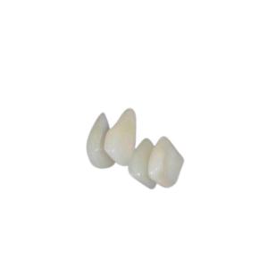 Easy Clean OEM Composite Teeth Veneers Long-Lasting Color Stability