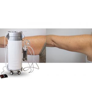 Power Assisted Surgical Vacuum Liposuction Cavitation Machine For Thighs / Arms / Back Treatment