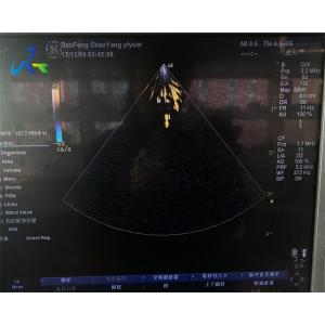 Housing Cracked GE 3S Ultrasound Probe Repair For Crystal Array Replacement