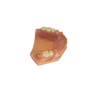 China 3D Printed Dentures For Dental Labs Based On Digital Data supplier