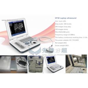 China Medical Home Pregnancy Ultrasound Machine DRF RDA Imaging USB Port supplier
