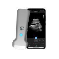 China 179mm Mobile Portable Wifi Ultrasound Scanner Supporting GPU on sale