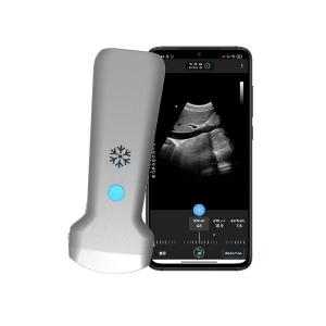 China 179mm Mobile Portable Wifi Ultrasound Scanner Supporting GPU supplier