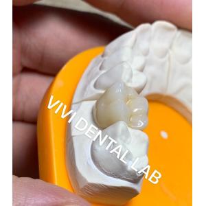 Solid Dental Lab Crowns 3D Pro High Translucency Full Zirconia Crowns China Dental Lab