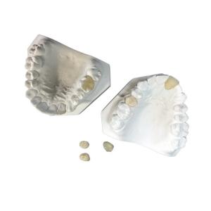 Easy Maintain OEM White Ceramic Dental Crown Veneer Inlay Onlay