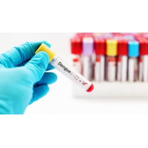 CE Approved Dengue Ns1 Antigen Test Kit Antibody Rapid Test Cassette