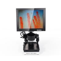 LCD Digital Biological Microscope Microcirculation Checking Capillary Microscope