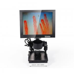 China LCD Digital Biological Microscope Microcirculation Checking Capillary Microscope supplier