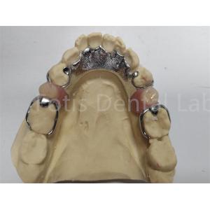 Adjustable Co Cr Partial Denture Comfortable Dental Prosthesis For Missing Teeth