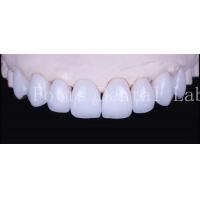 China Adhesive Bonding Cement Natural White Veneers With High Translucency on sale