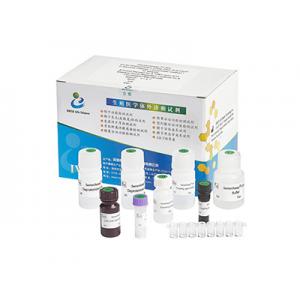 China High Accuracy Male Fertility Test Kit 40T/Kit For Male Infertility Diagnosis supplier