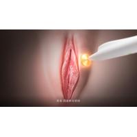 China Female RF Vaginal Rejuvenation Thermage Vulva Rejuvenation Laser Urinary Incontinence on sale