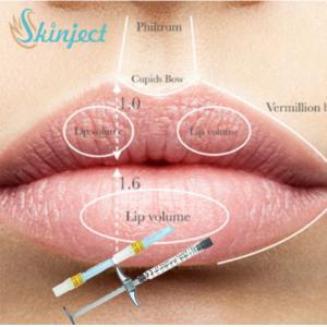 Full Lip Cheek Injectable Dermal Filler Hyaluronic Acid HA Filler 1ml 2ml 5ml