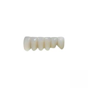 OEM Implant Zirconia Dental Crown Fixed Bridge