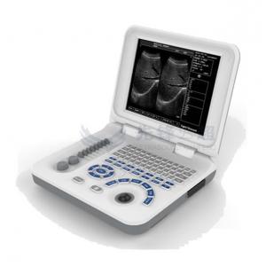 China OEM ODM Portable Ultrasound Machines For Home Use supplier